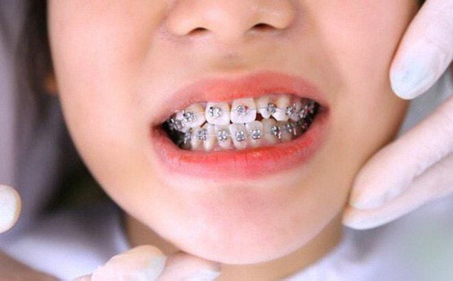 Nha Khoa ADORA Biên Hòa - Đồng Nai
