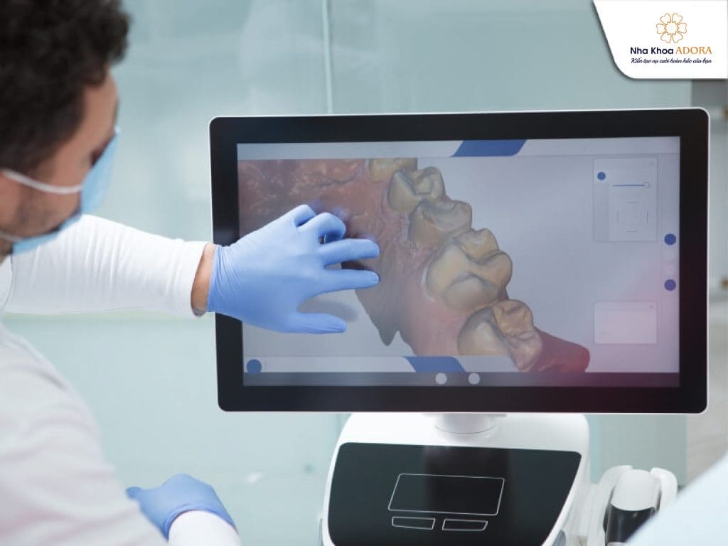 trồng răng Implant Đồng Nai