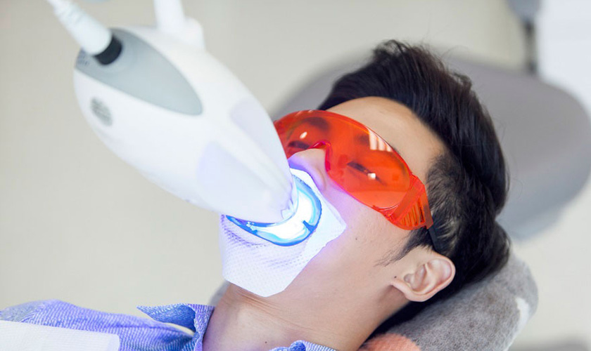tẩy trắng răng giá bao nhiêu Đồng Nai