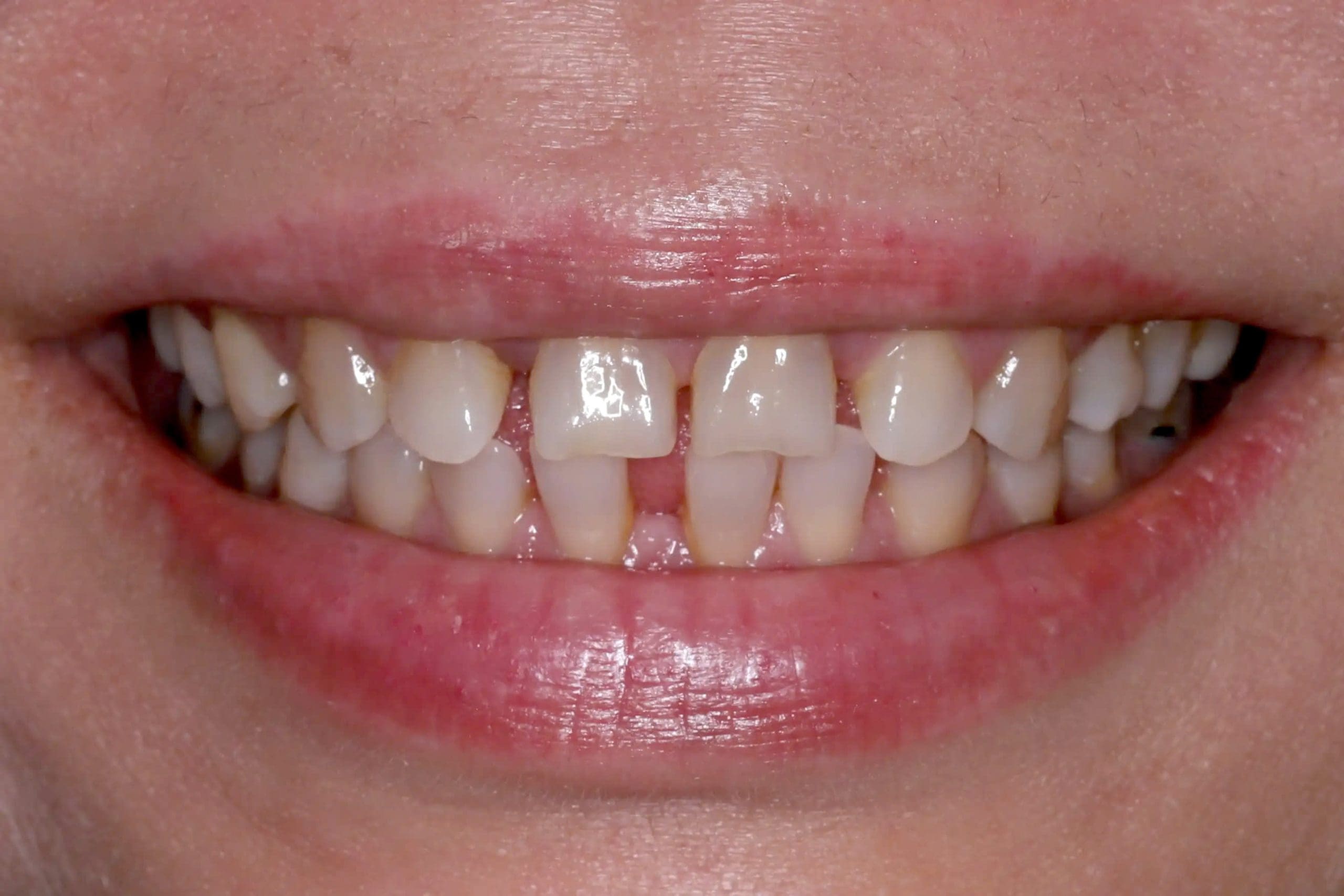 Before image