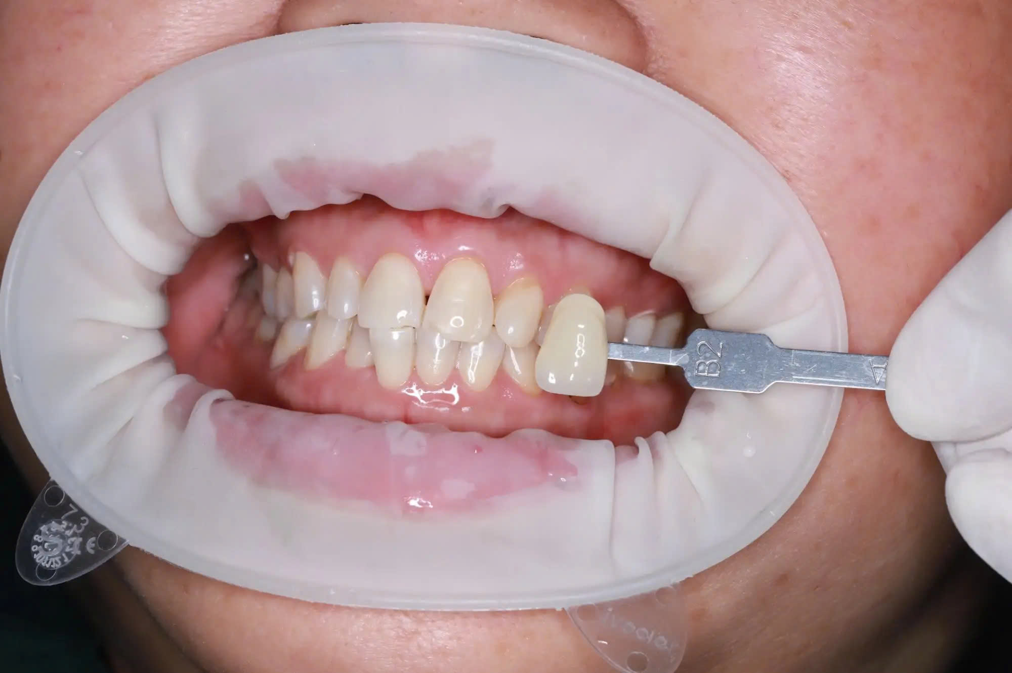 Before image