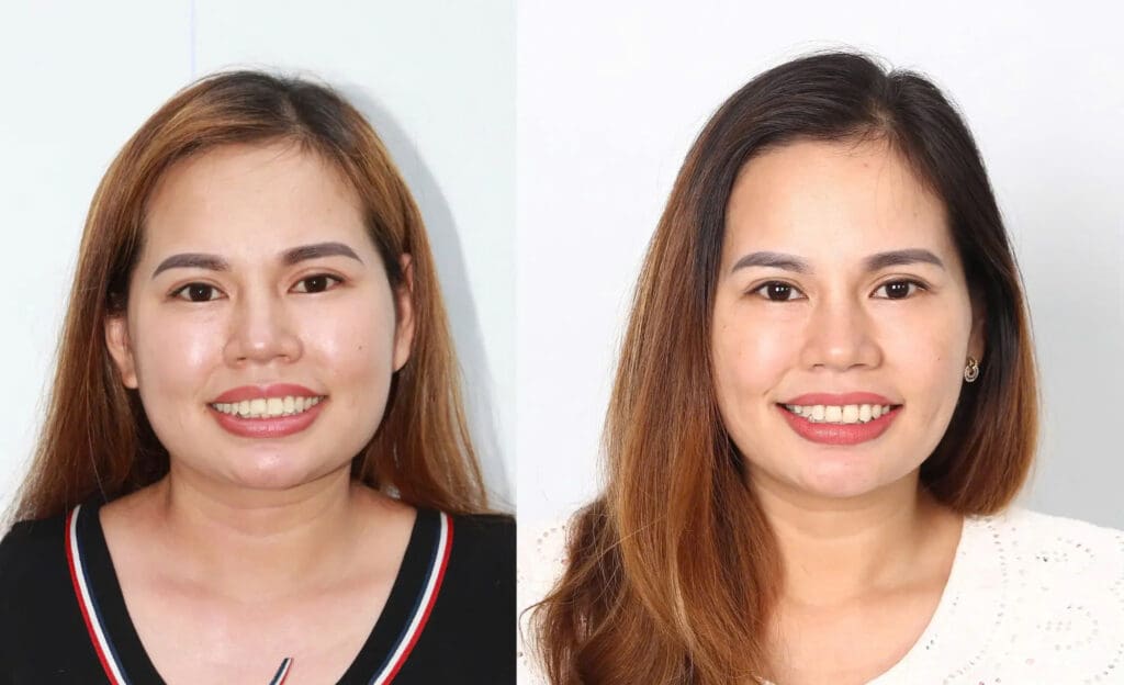 Nha Khoa ADORA Biên Hòa - Đồng Nai