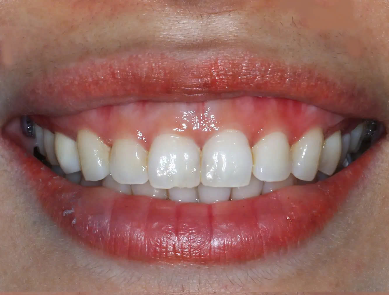 Before image
