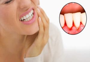điều trị sâu răng Đồng Nai