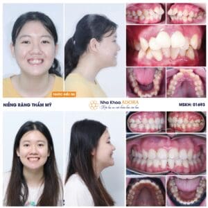 nha khoa trả góp Đồng Nai